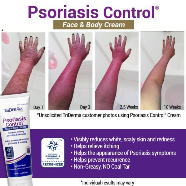 TriDerma Psoriasis Cream FSA Eligible - Image 2