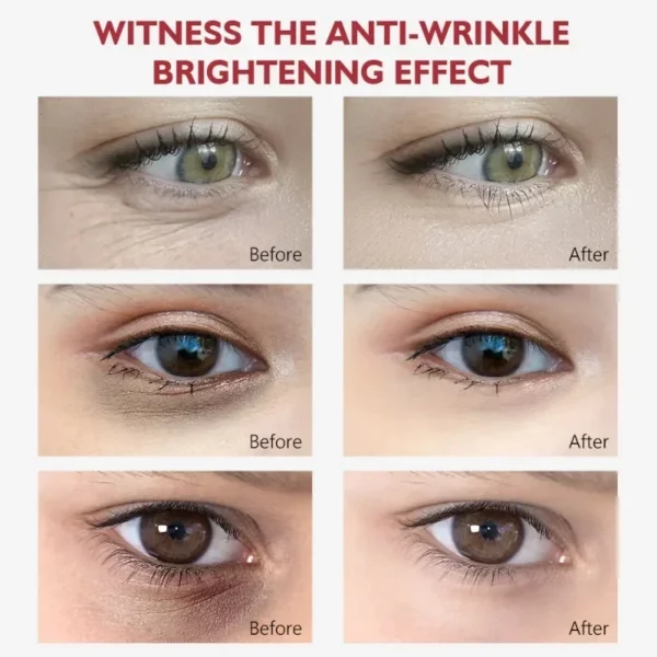 Nicotinamide Eyes Cream Dark Circles Remover - Image 2