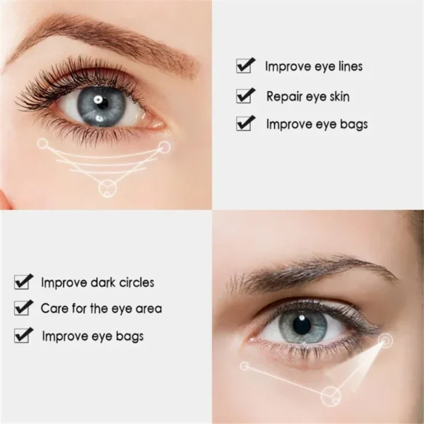 Nicotinamide Eyes Cream Dark Circles Remover - Image 4