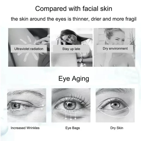 Nicotinamide Eyes Cream Dark Circles Remover - Image 5